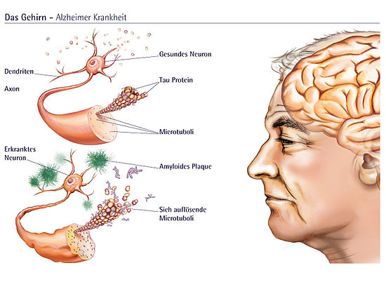 Illustration eines Gehirns und Details von Nervenzellen