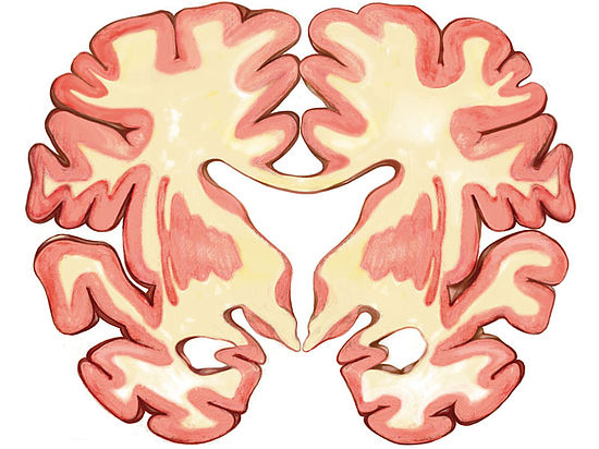 Illustration eines Querschnitts durch ein menschliches Gehirn