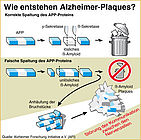 Infografik Alzheimer-Plaques