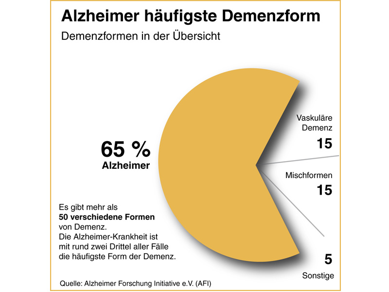 Tortendiagramm zeigt die Häufigkeit der Alzheimer-Krankheit