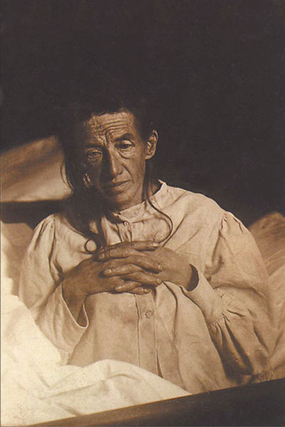 Foto von Auguste Deter, einer Patientin des Psychiaters Alois Alzheimer
